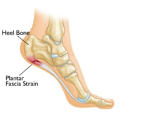Plantar Fascia